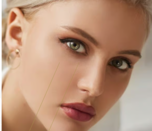 Rediscover Your Youth: The Ultimate Guide to Facelift in Dubai
